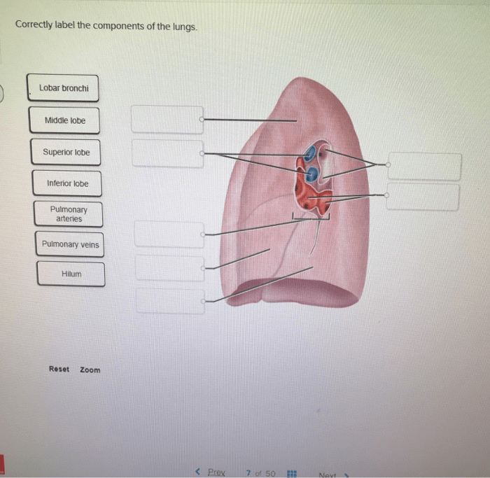 Correctly label the components of the lungs